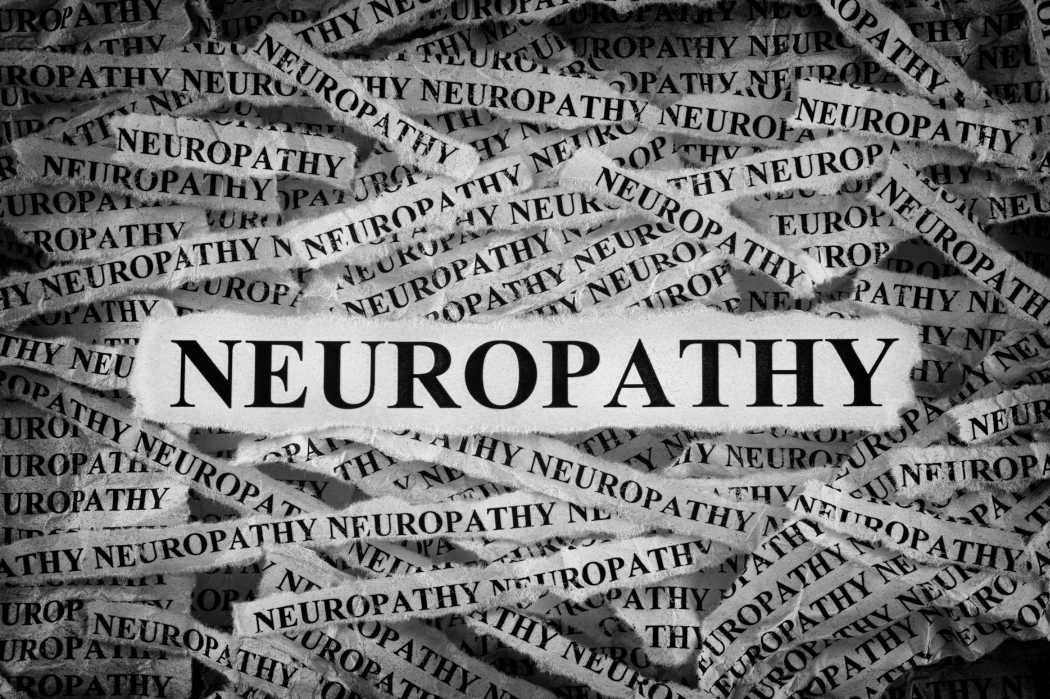 What is neuropathy?